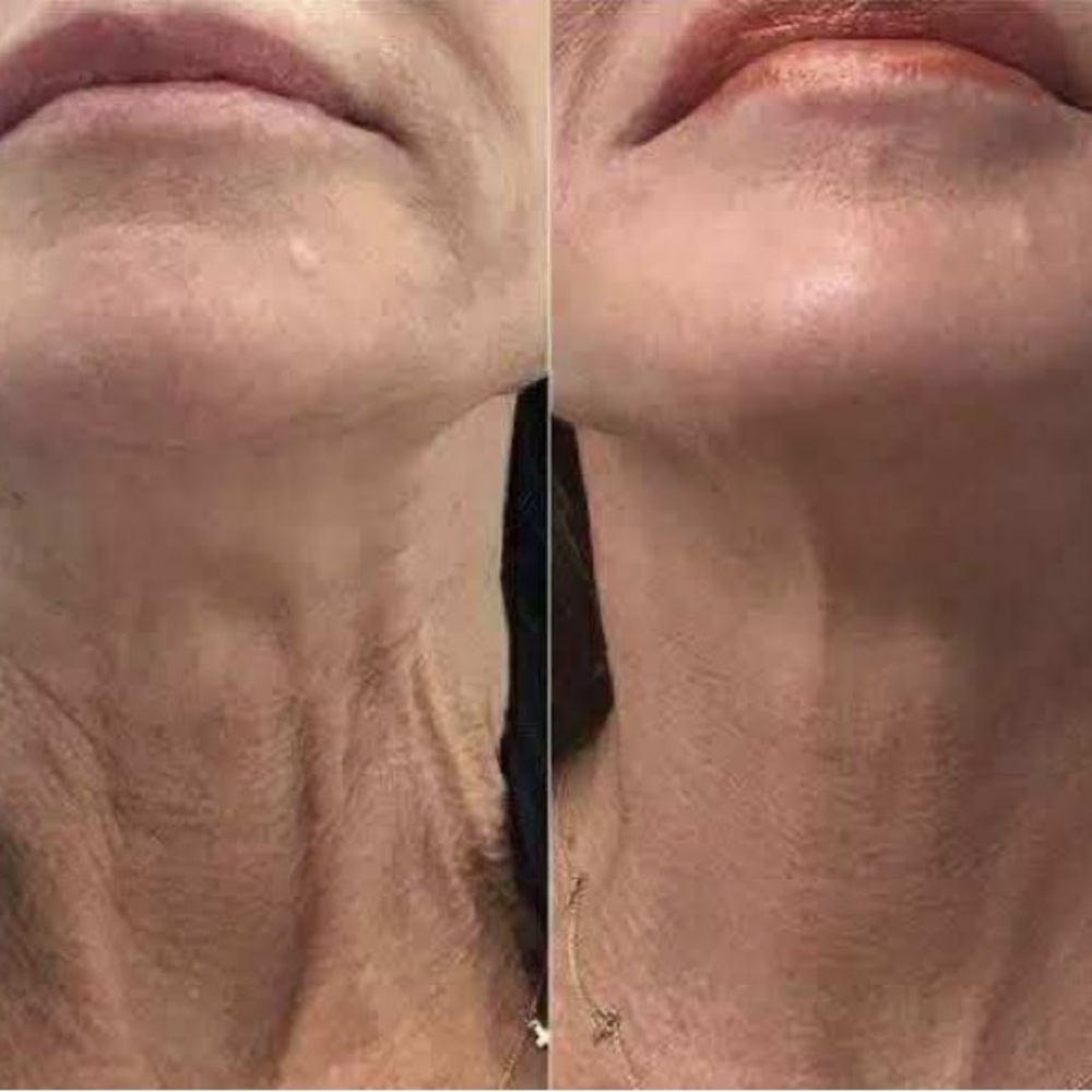 FIRMING CREAM